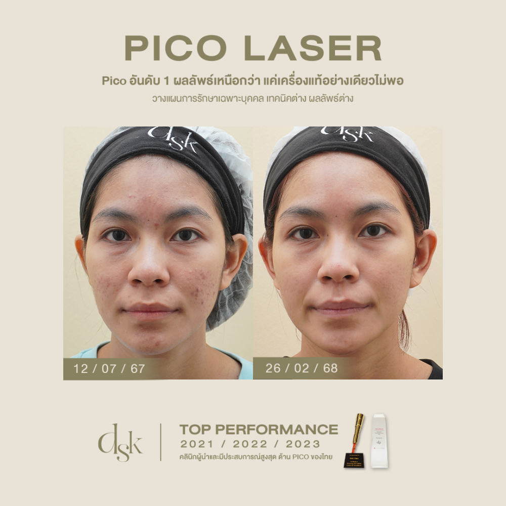 hn.S67-002039_cudtompico pro