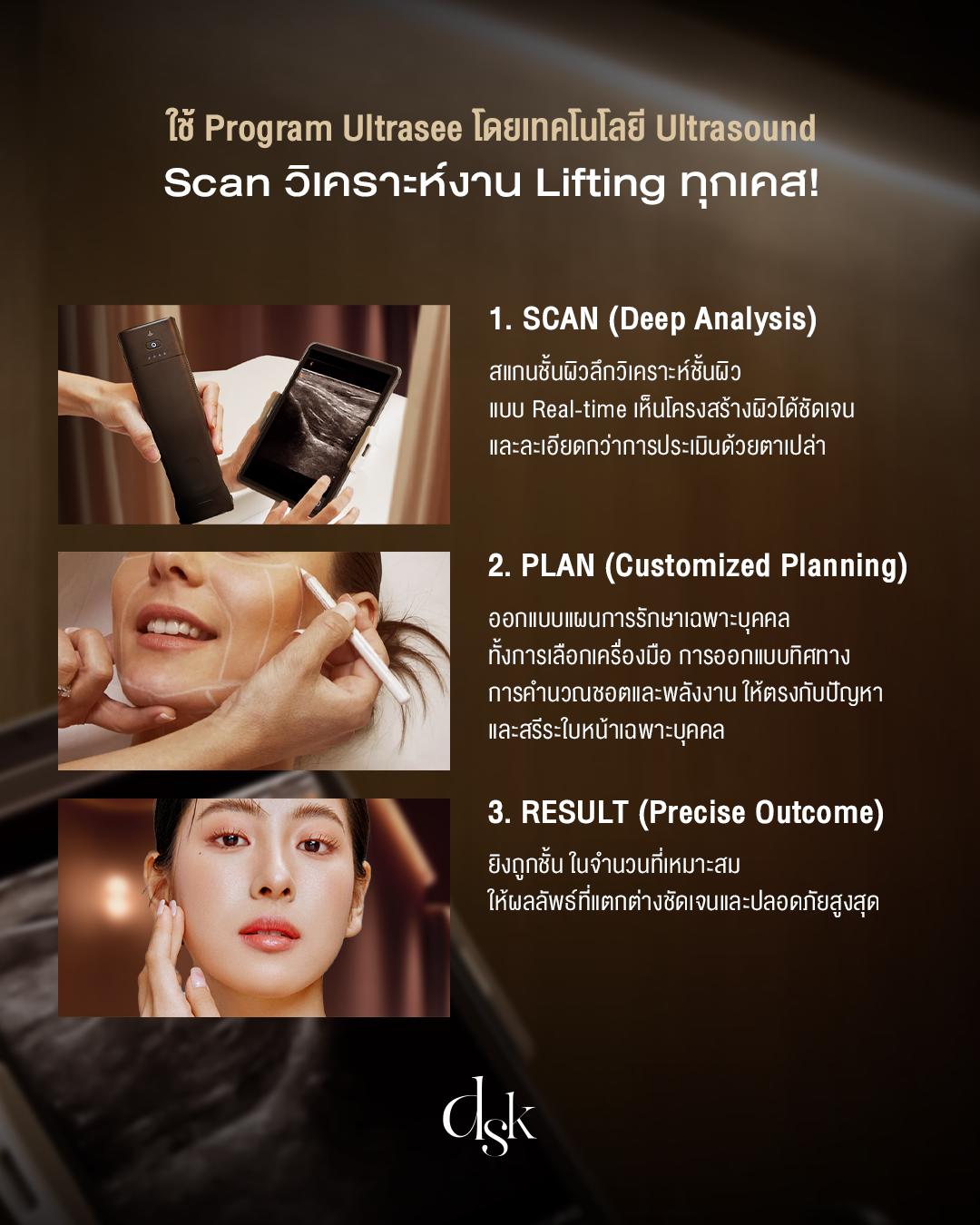 Ultrasee คือ