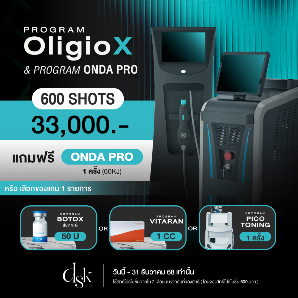 oligiox_onda