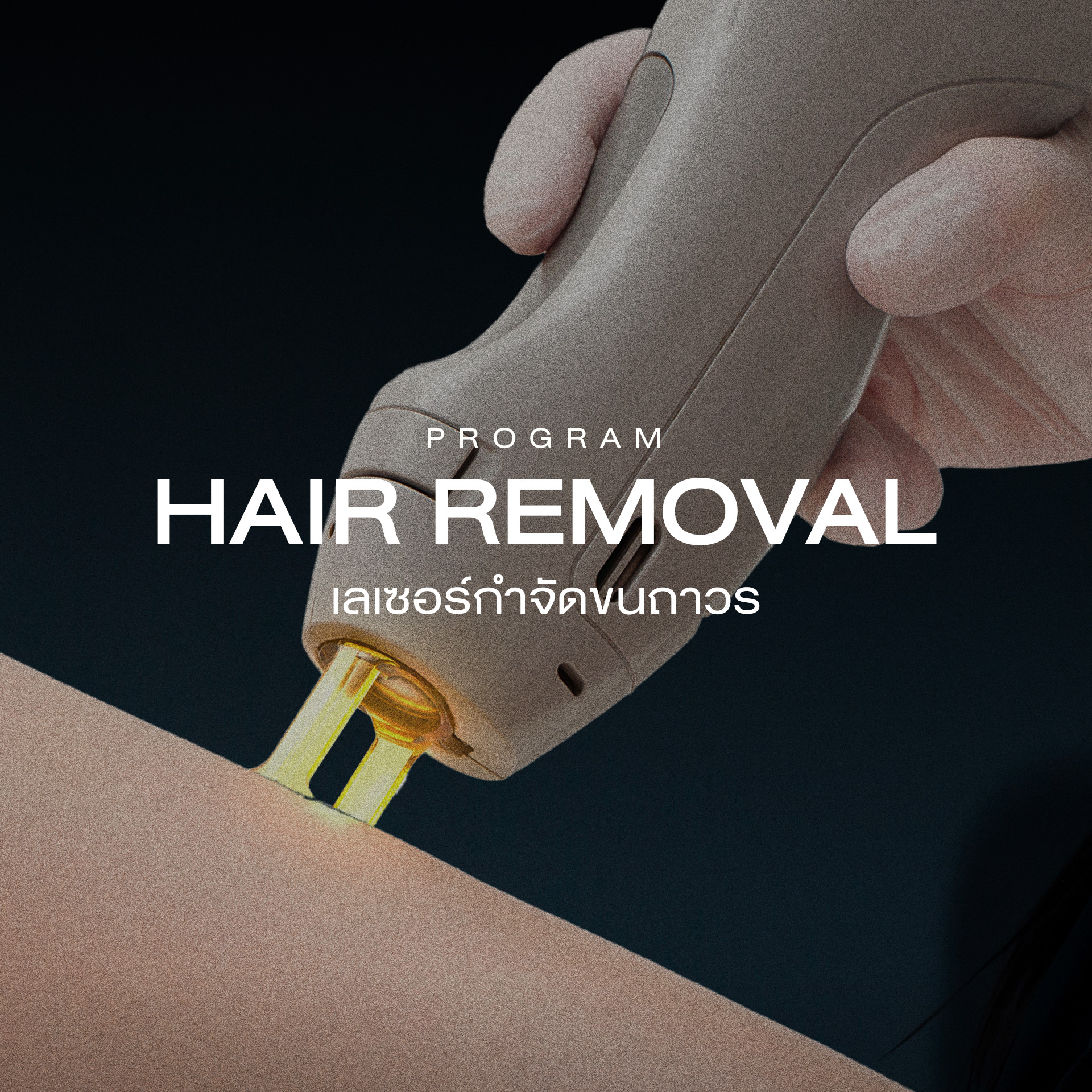 กำจัดขนถาวรอย่างอ่อนโยน