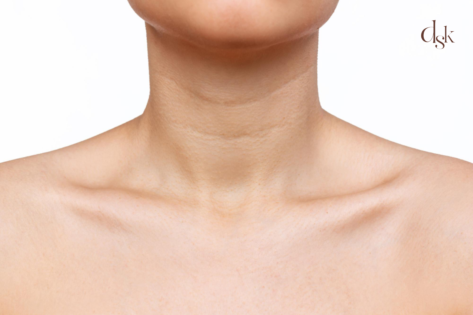 รักษาเส้นที่คอแนวนอน