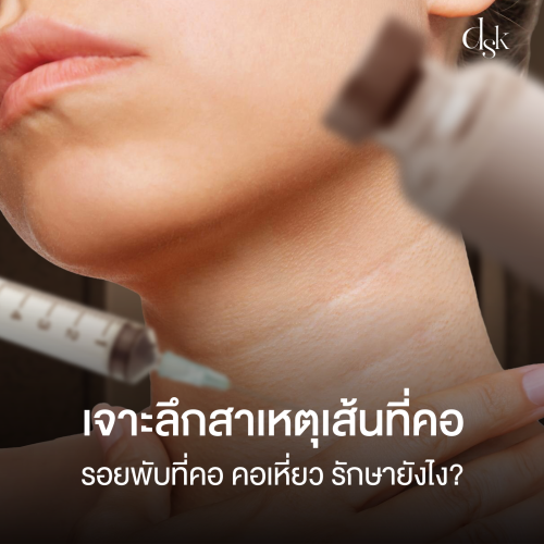 เจาะลึกสาเหตุเส้นที่คอ รอยพับที่คอ คอเหี่ยว รักษายังไง? หาคำตอบได้ที่ DSK Clinic