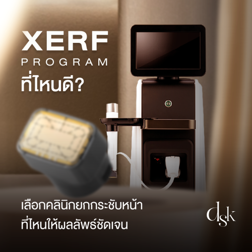 โปรแกรม XERF ที่ไหนดี? เลือกคลินิกยกกระชับหน้าที่ไหนให้ผลลัพธ์ชัดเจน