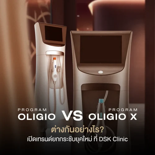 โปรแกรม OligioX vs Oligio ต่างกันอย่างไร? เปิดเทรนด์ยกกระชับยุคใหม่ ที่ DSK Clinic
