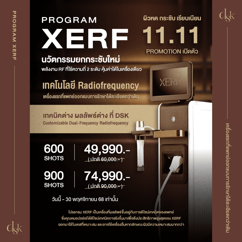 ราคา XERF