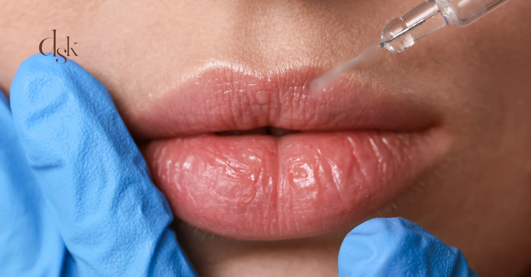 โปรแกรมฟิลเลอร์ปาก