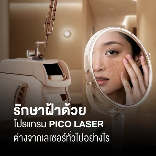 รักษาฝ้าด้วยโปรแกรม Pico Laser ต่างจากเลเซอร์ทั่วไปอย่างไร