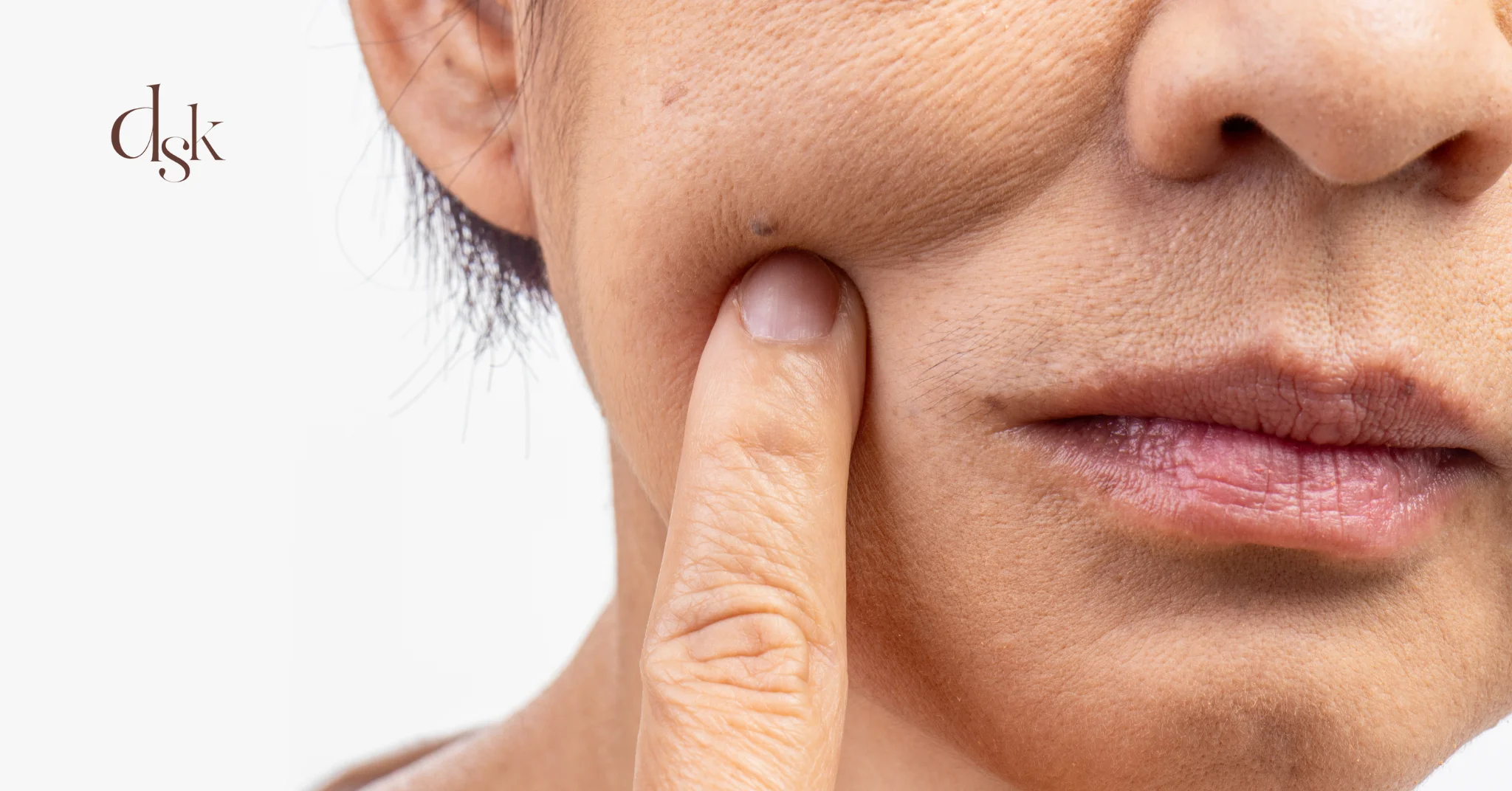 แก้มใหญ่เกิดจากอะไร