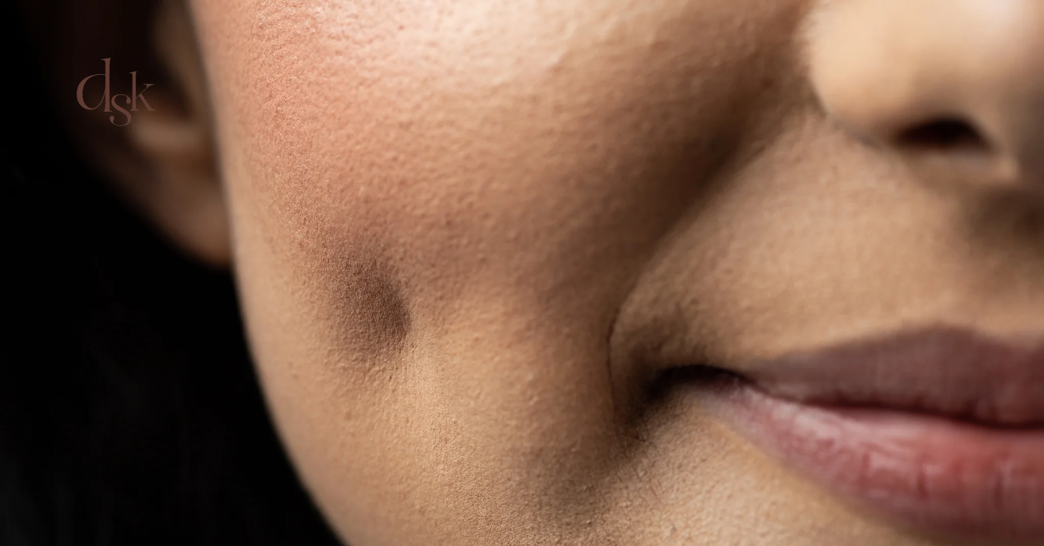 แก้มใหญ่ส่งผลต่อภาพรวมของใบหน้าอย่างไร