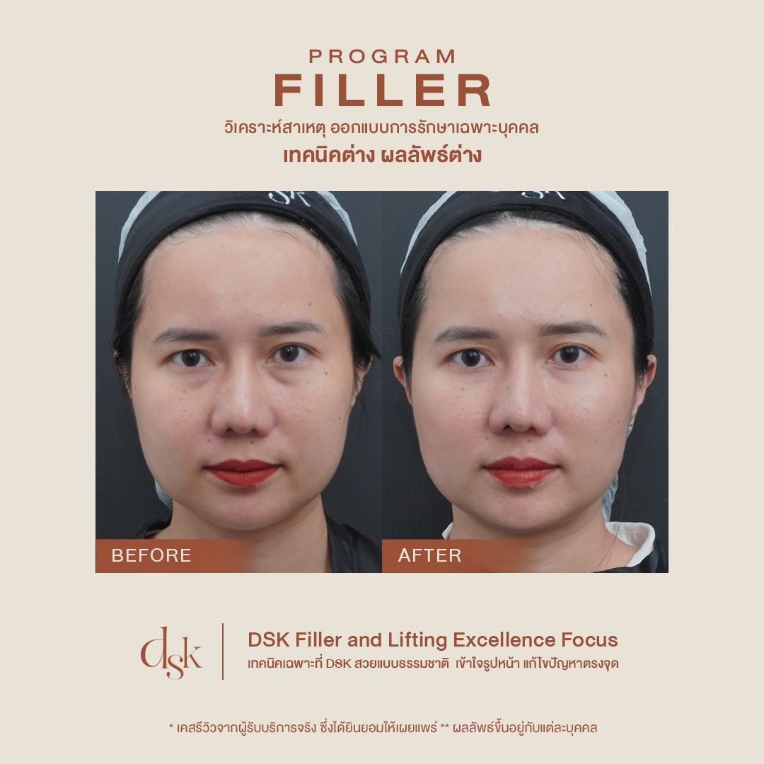 Program Filler - DSK Clinic I The First Customized Clinic
