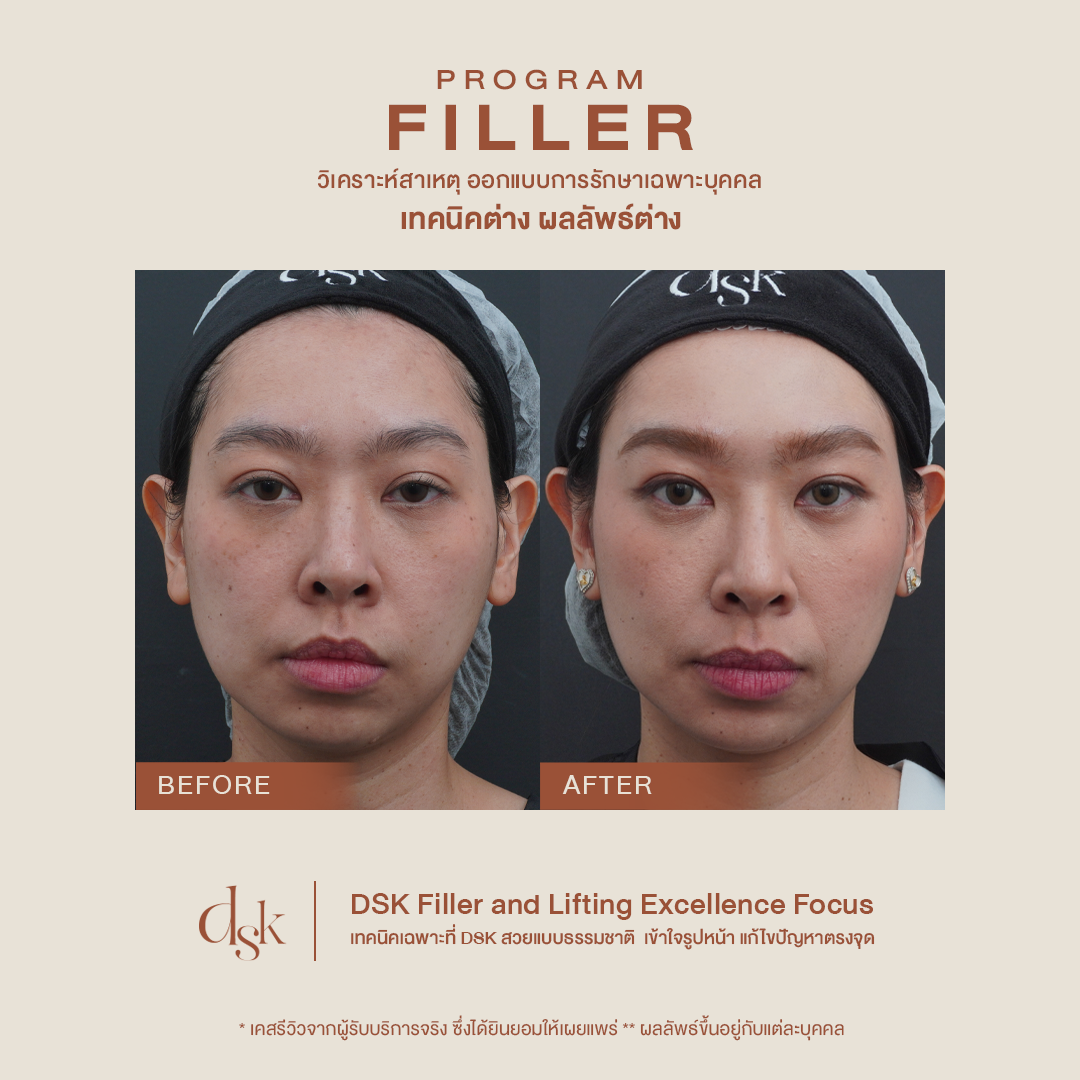 Program Filler - DSK Clinic I The First Customized Clinic