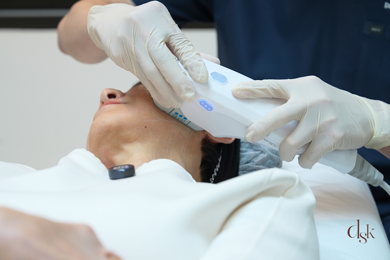 Ulthera Prime ที่ DSK Clinic