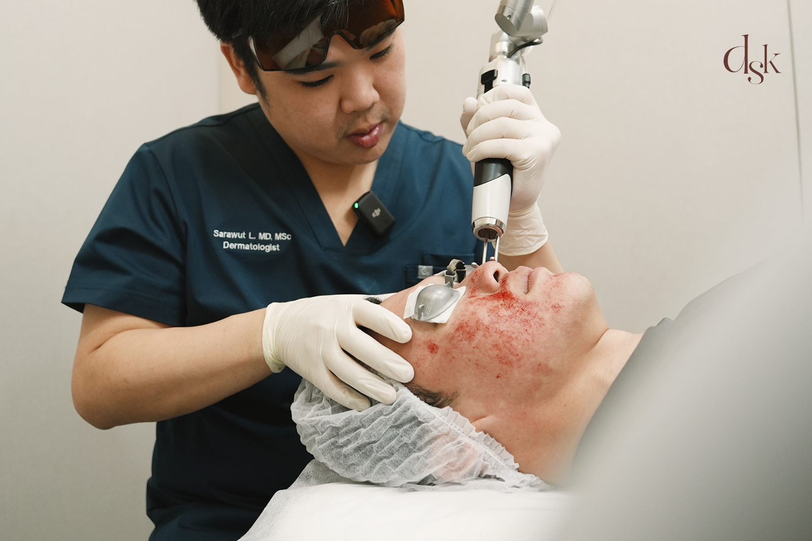 เลเซอร์หน้าใส Pico Laser