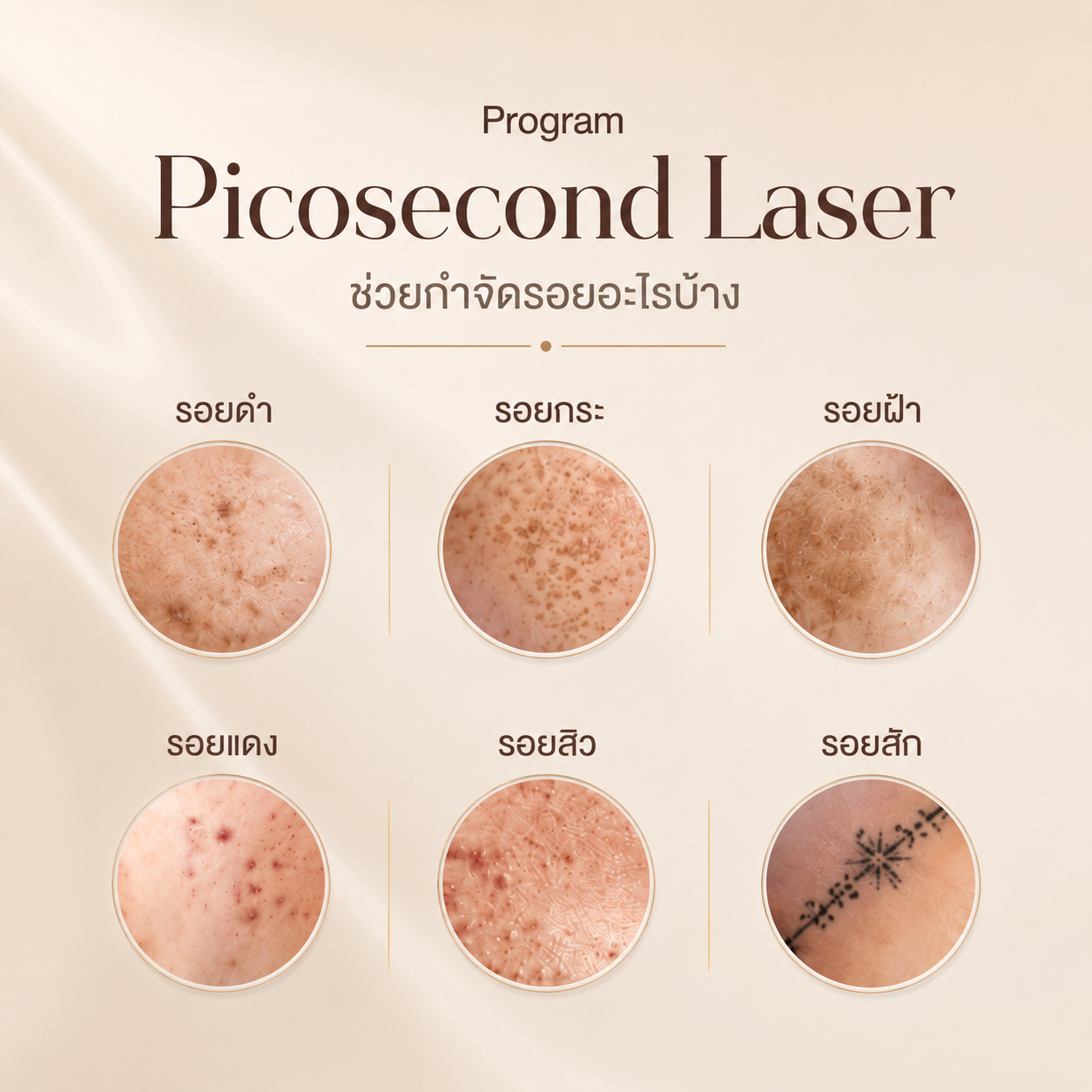 Pico laser กี่ครั้งเห็นผล