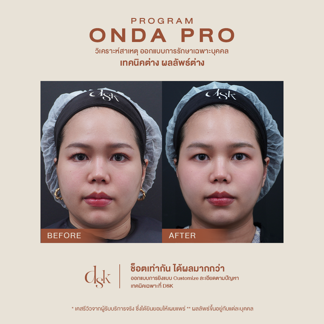 Onda pro Review