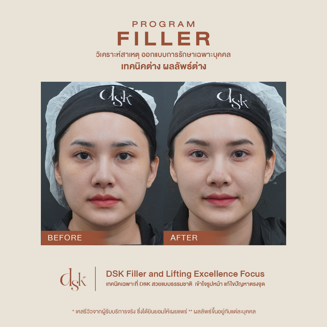 รีวิว Definisse