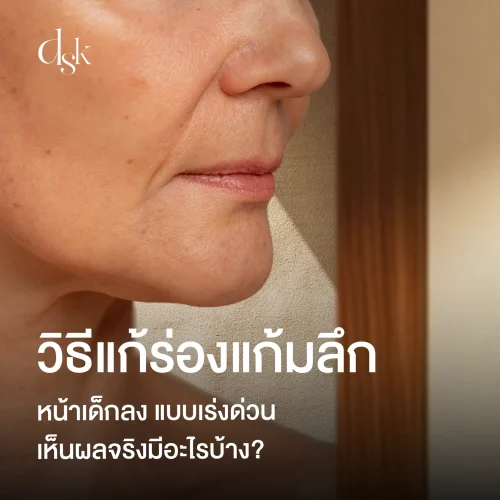 วิธีจัดการร่องแก้มลึก หน้าแก่กว่าวัย ปัญหาริ้วรอย แบบเร่งด่วน เห็นผลจริงมีอะไรบ้าง?