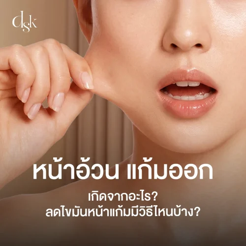 หน้าอ้วน แก้มออก สาเหตุเกิดจากอะไร? อยากลดหน้าอ้วน ไขมันหน้าแก้มมีวิธีไหนบ้าง