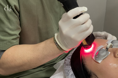 What is RedTouch Pro Laser? Benefits, Results, and How It Compares to Other Lasers