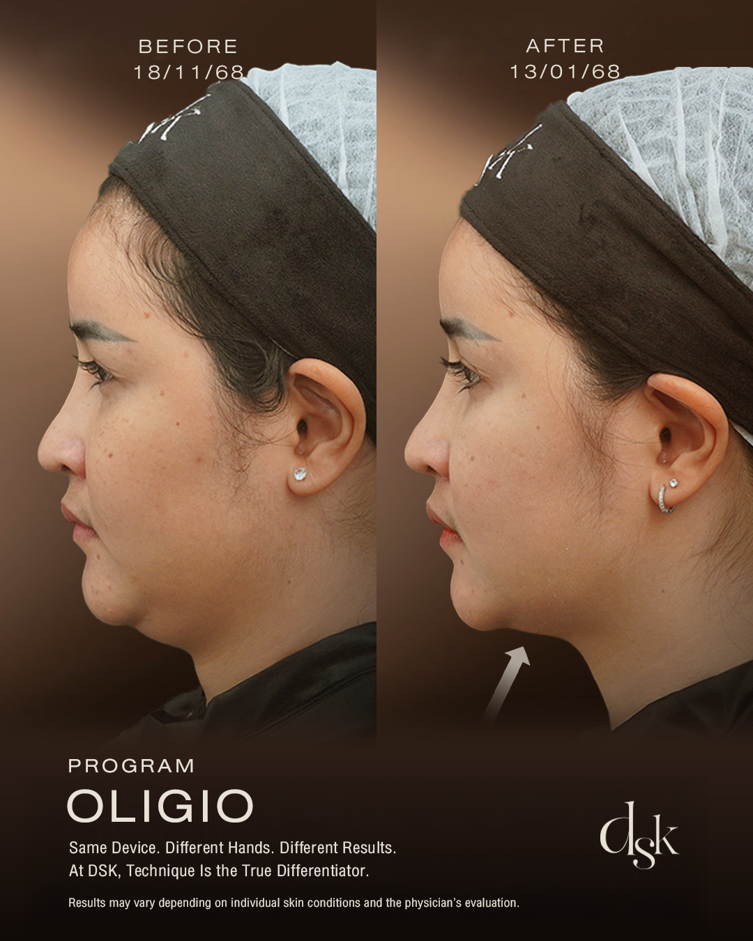 oligio clinic bangkok