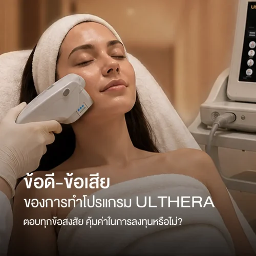ข้อดี-ข้อเสียของการทำโปรแกรม Ulthera ตอบทุกข้อสงสัย คุ้มค่าในการลงทุนหรือไม่?