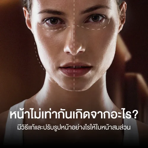 หน้าไม่เท่ากันเกิดจากอะไร? มีวิธีแก้และปรับรูปหน้าอย่างไรให้ใบหน้าสมส่วน