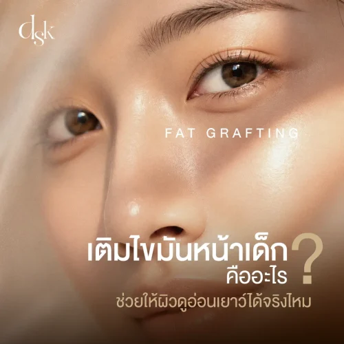 เติมไขมันหน้าเด็ก (Fat Grafting) คืออะไร? ช่วยให้ผิวดูอ่อนเยาว์ได้จริงไหม