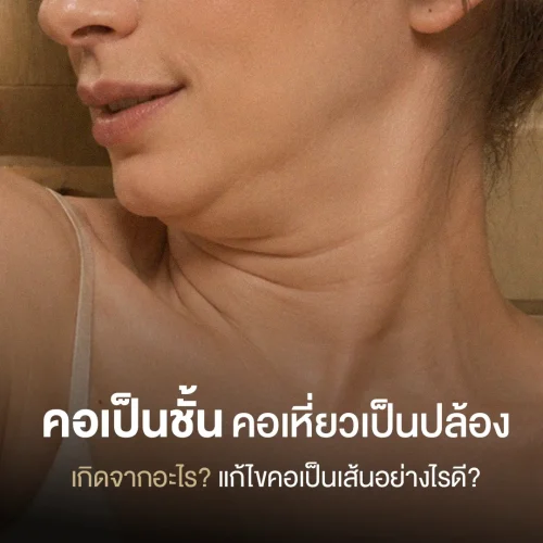 คอเป็นชั้น คอเหี่ยวเป็นปล้อง เกิดจากอะไร แก้ไขคอเป็นเส้นอย่างไรดี?