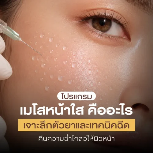 เมโสหน้าใสคืออะไร? เจาะลึกตัวยาและเทคนิคฉีดคืนความฉ่ำโกลว์ให้ผิวหน้า