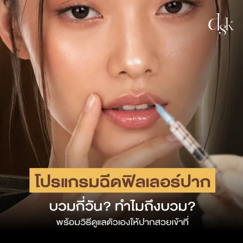 โปรแกรมฉีดฟิลเลอร์ปาก บวมกี่วัน? ทำไมถึงบวม พร้อมวิธีดูแลตัวเองให้ปากสวยเข้าที่