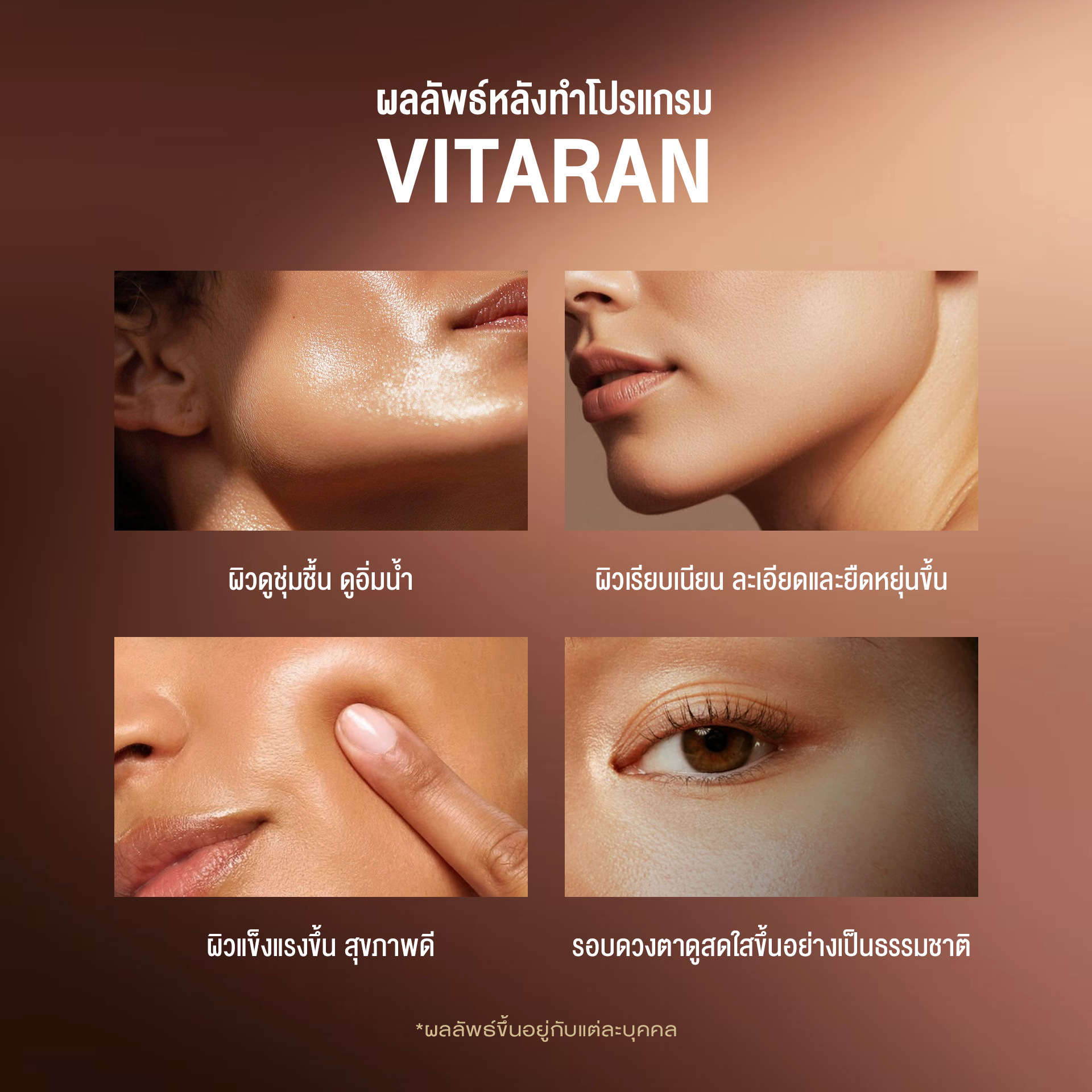 Vitaran ช่วยอะไร