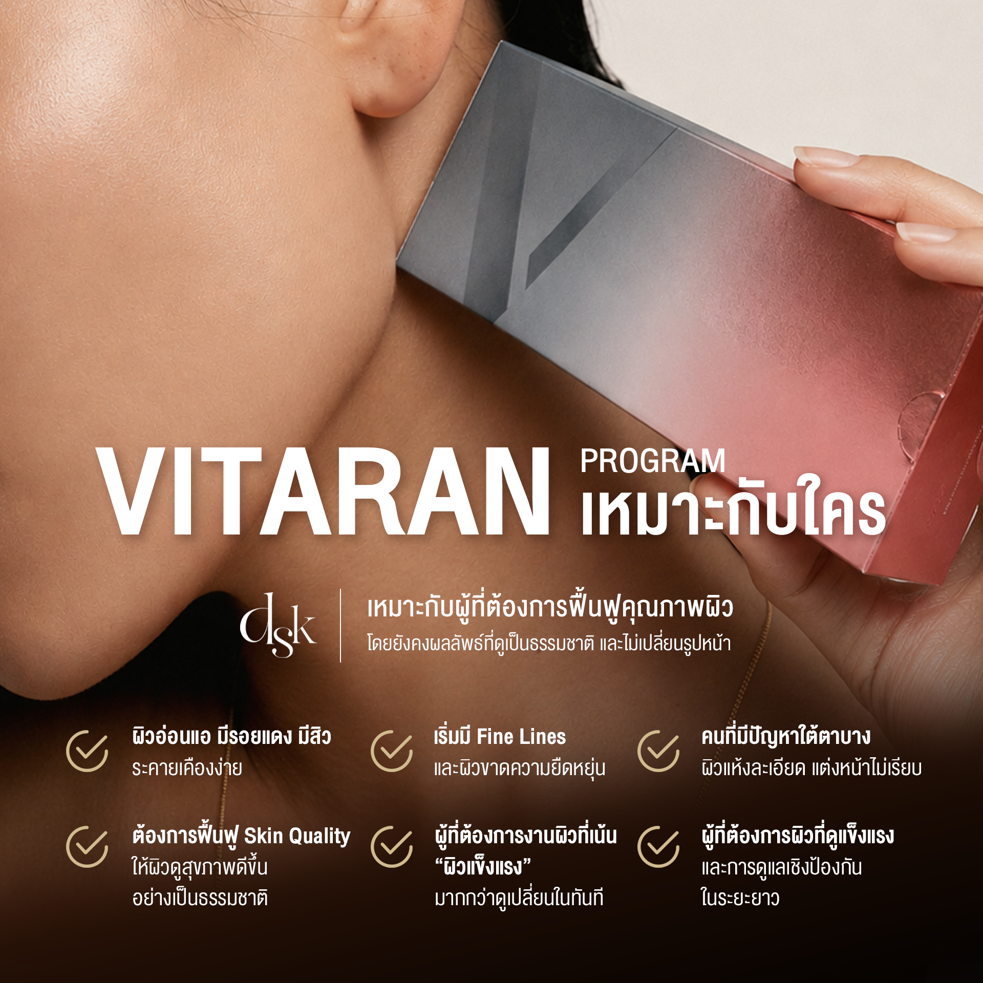 Vitaran เหมาะกับใคร