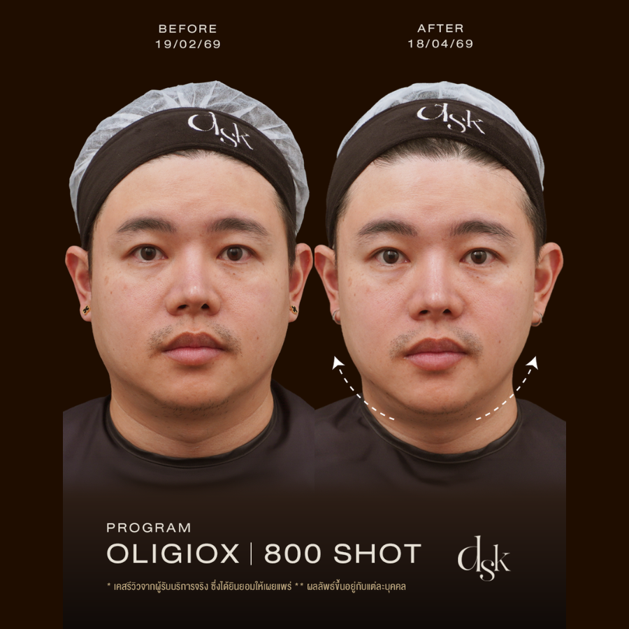 Oligio X รีวิว