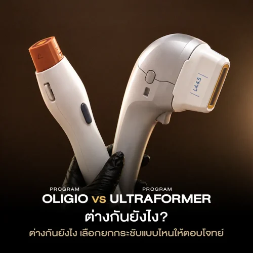 โปรแกรม Oligio VS โปรแกรม Ultraformer ต่างกันยังไง เลือกยกกระชับแบบไหนให้ตอบโจทย์