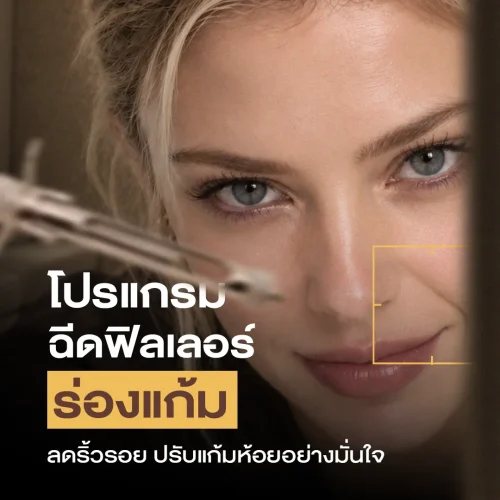 โปรแกรมฉีดฟิลเลอร์ร่องแก้ม ลดริ้วรอย ปรับแก้มห้อยอย่างมั่นใจ