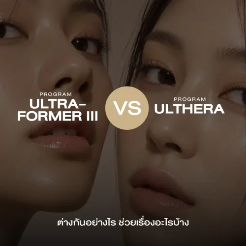 โปรแกรม Ultraformer III กับโปรแกรม Ulthera ต่างกันอย่างไร ช่วยเรื่องอะไรบ้าง