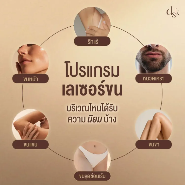 โปรแกรมเลเซอร์ขน บริเวณไหนได้บ้าง
