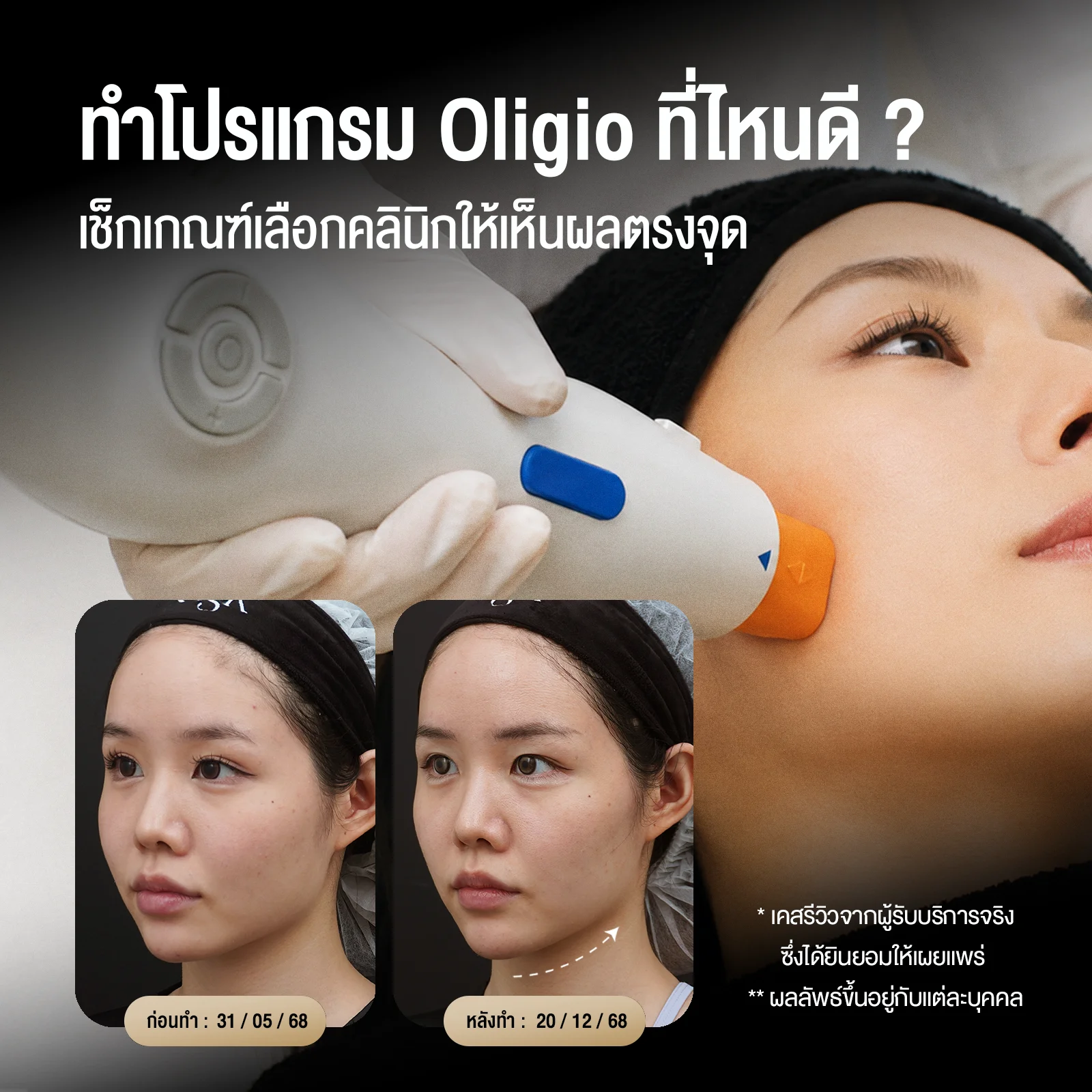 ทำโปรแกรม Oligio ที่ไหนดี
