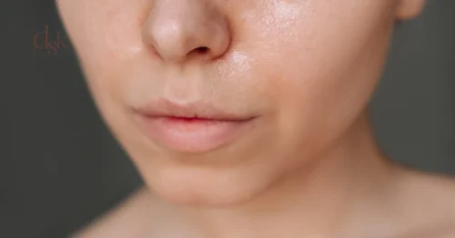 มารู้จักว่าผิวผสมคืออะไร? พร้อมเข้าใจวิธีดูแลผิวผสม เพื่อให้ผิวสวยสุขภาพดี