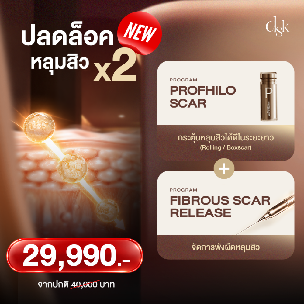 Profhilo+Fiborous ปลอล็อคหลุมสิว2